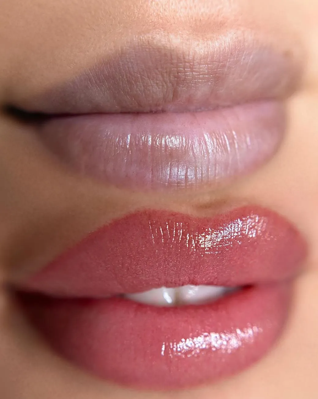 Why Skin Type Matters